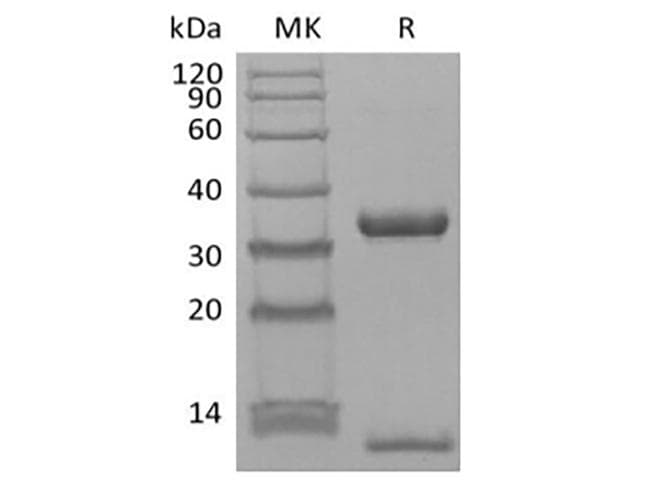 Human FCGRT / FCRN Protein (Recombinant AVI-6His, C-terminus)