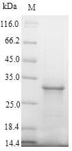 Human SLC5A2 / SGLT2 Protein (Recombinant 10His-SUMO, N-terminus + Myc, C-terminus)