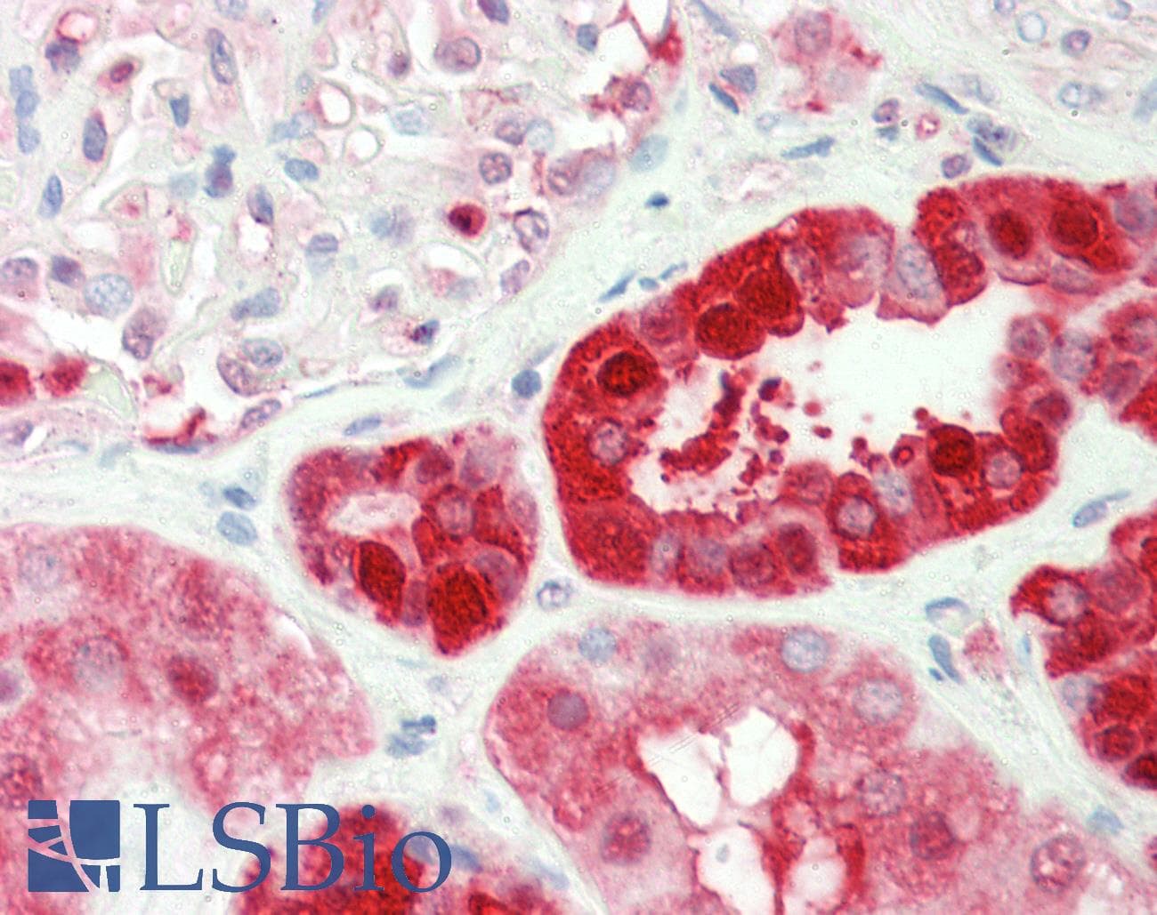 IHC-plus™ GPI Antibody (clone 4B11)