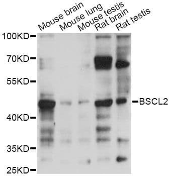 Polyclonal Rabbit anti-Human BSCL2 Antibody (WB)