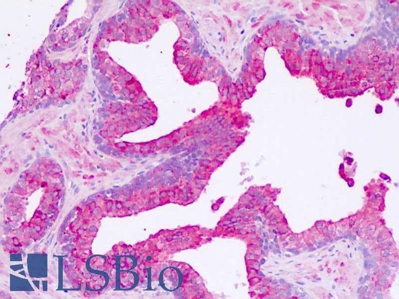 IHC-plus™ HTR2B / 5-HT2B Receptor Antibody (aa15-64)