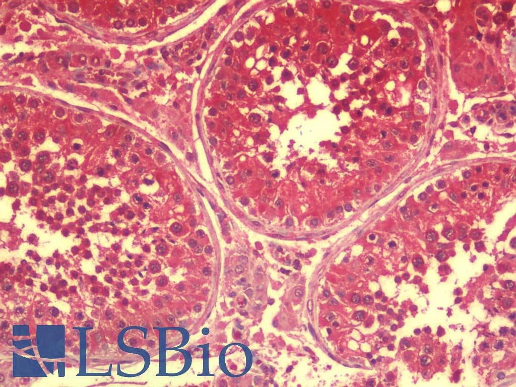 IHC-plus™ SPATA18 / MIEAP Antibody