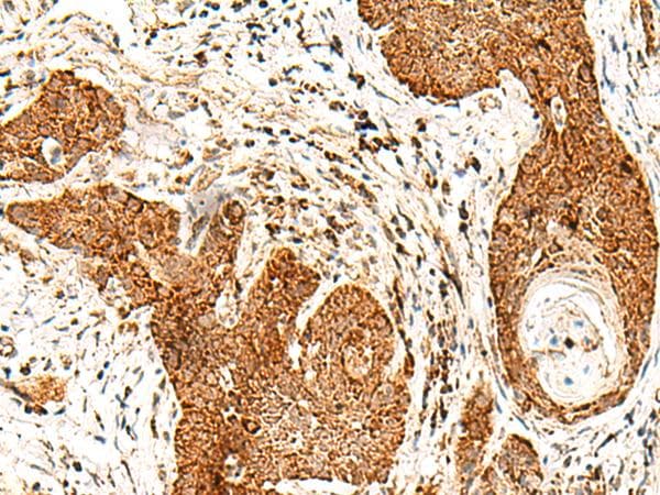 SMOC1 Antibody