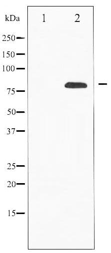 Polyclonal Rabbit anti-Human TP73 / p73 Antibody (WB)