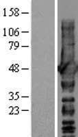 Human NDRG1 Protein (Over-Expression Lysate Myc-DDK (Flag))
