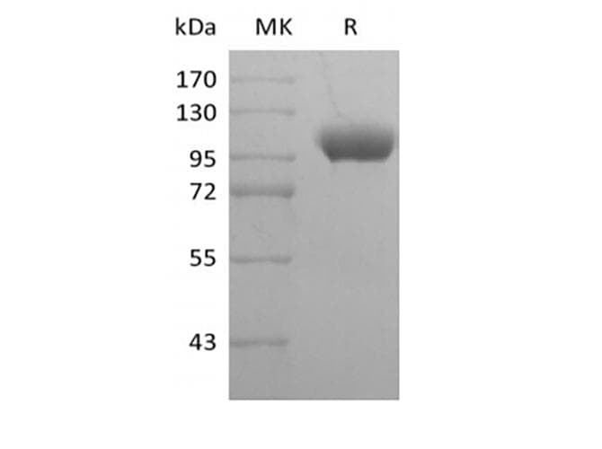 Human ILT2 / CD85 Protein (Recombinant Fc, C-terminus)