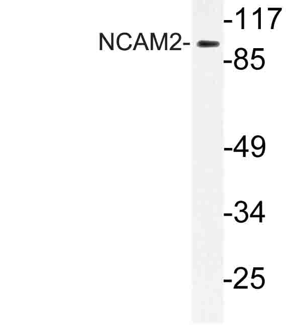 NCAM2 Antibody (Leu296)