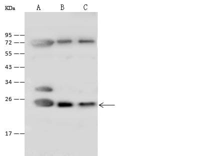 ATP5O Antibody