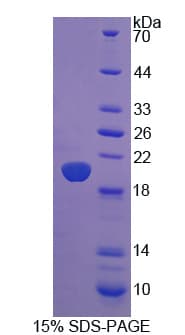 Human CD74 / CLIP Protein (Recombinant His)