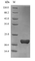 Human TREM2 / TREM-2 Protein (Recombinant 6His, N-terminus)