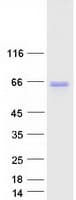 Human ACBD5 Protein (Recombinant Myc-DDK (Flag))