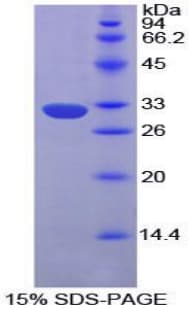 Mouse EPHA1 / EPH Receptor A1 Protein (Recombinant His-T7)