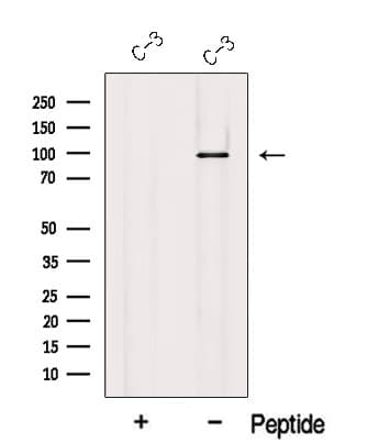 USHBP1 Antibody