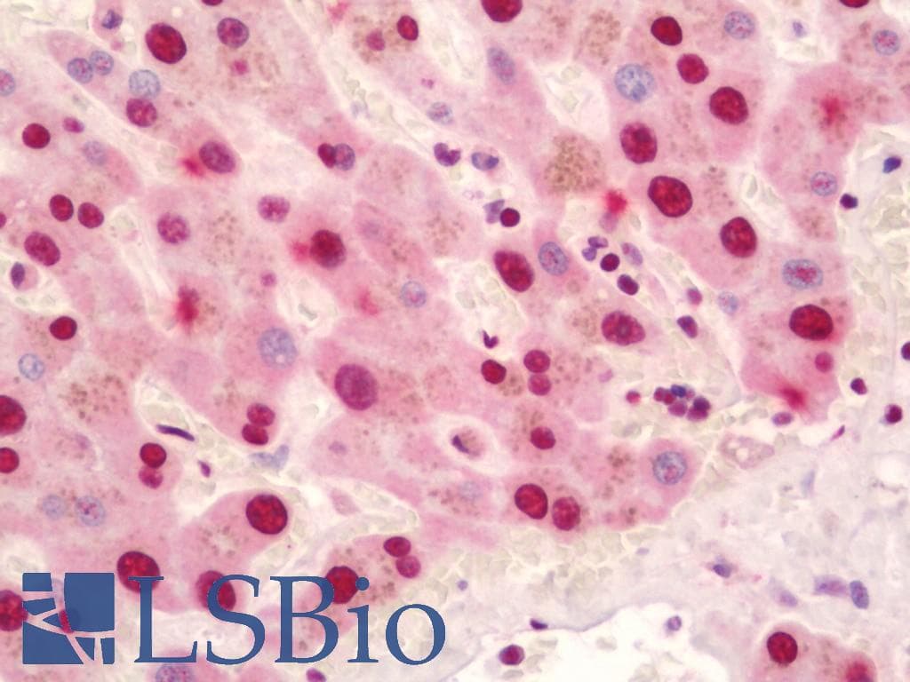 IHC-plus™ NF90 / ILF3 Antibody (aa302-351)