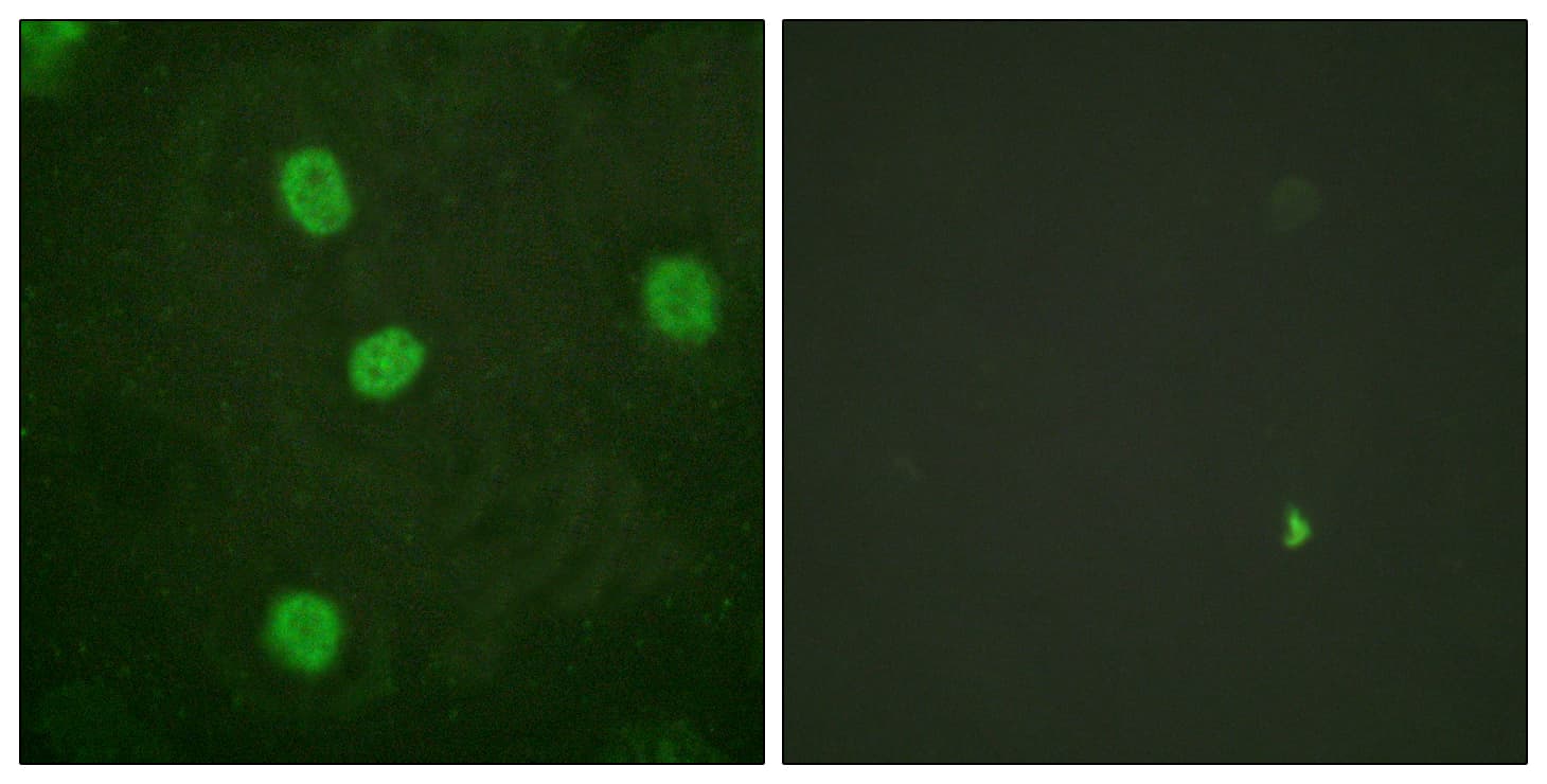MYBL2 Antibody (phospho-Ser577/Ser581)