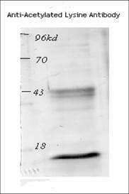 Polyclonal Rabbit Acetyl-Lysine Antibody (IF, WB)