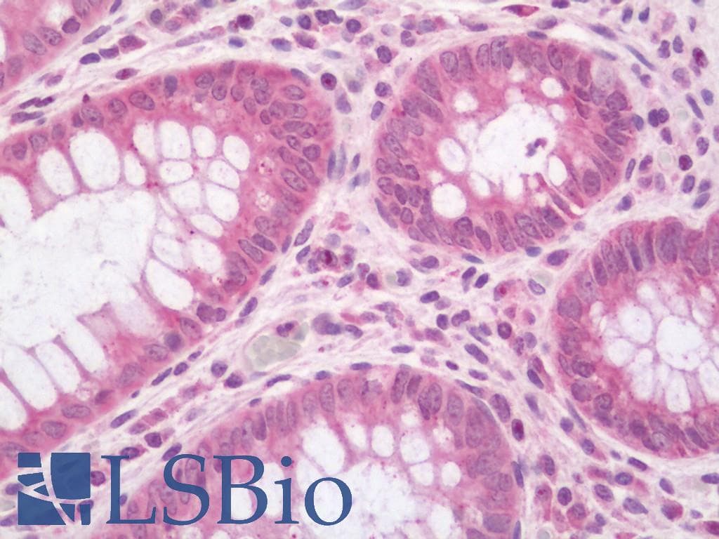 LRRC40 Antibody (Biotin)