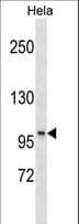SSH1 Antibody (aa227-254)
