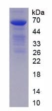 Rat CD274 / B7-H1 / PD-L1 Protein (Recombinant His-GST)