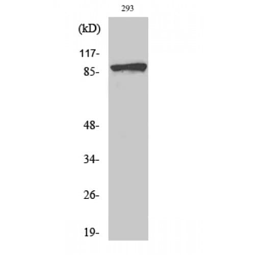 CTNNB1 / Beta Catenin Antibody (10-90 aa)
