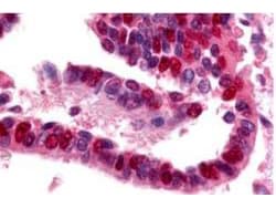 UBA1 / UBE1 Antibody