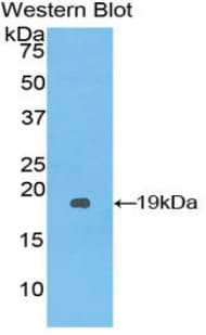 SERPINA10 / PZI Antibody (aa6-125, Cy3)
