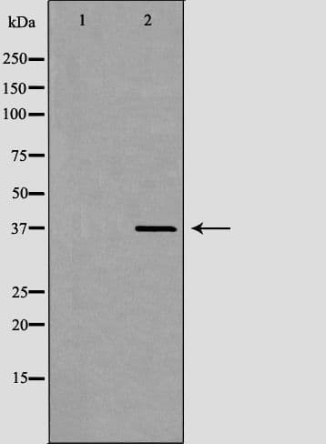 APOH / Apolipoprotein H Antibody