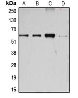 CCNB1 / Cyclin B1 Antibody (Internal)