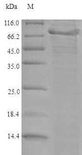Mouse ADAMTS5 Protein (Recombinant 6His, N-terminus)