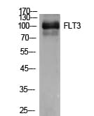 Polyclonal Rabbit anti-Human CD135 / FLT3 Antibody (WB)