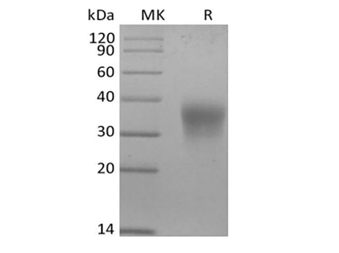 Mouse EPO / Erythropoietin Protein (Recombinant 6His, C-terminus)
