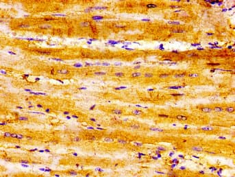 SEMA3A / Semaphorin 3A Antibody