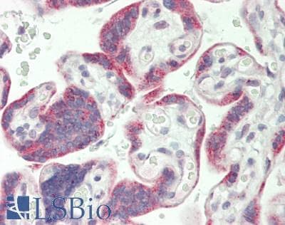 IHC-plus™ Polyclonal Rabbit anti-Human RPS6KA5 / MSK1 Antibody (aa181-230, IHC, WB)