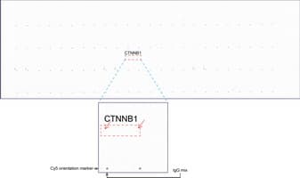 Monoclonal Mouse anti-Human CTNNB1 / Beta Catenin Antibody (clone UMAB15, Carrier-free, IHC, IF, WB)