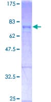 Human FOS / c-FOS Protein (Recombinant GST, N-terminus)