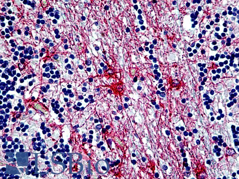 IHC-plus™ GFAP Antibody