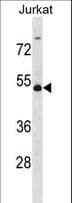 Polyclonal Rabbit anti-Human WTAP Antibody (aa272-301, WB)