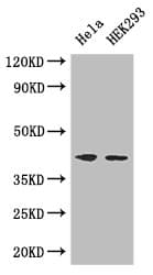 ACTG1 / Gamma Actin Antibody