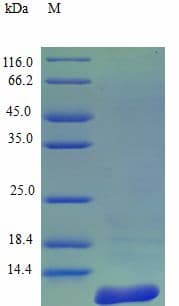 Human CCL8 / MCP2 Protein (Recombinant)
