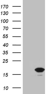 p16INK4a / CDKN2A Antibody (clone OTI11A6)