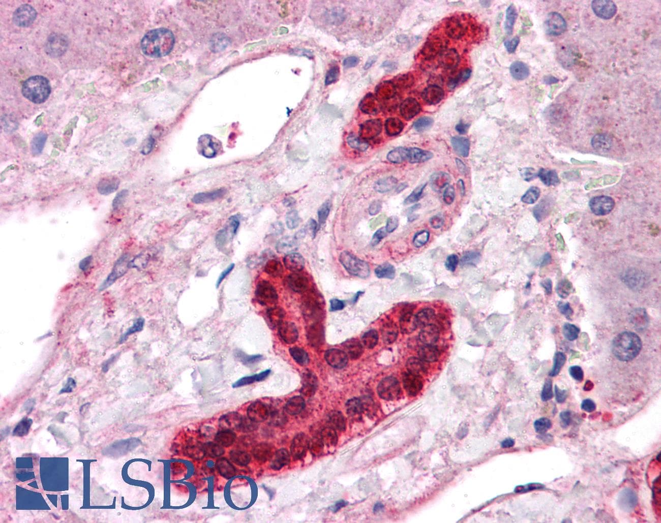 IHC-plus™ Polyclonal Rabbit anti-Human ESX1 Antibody (IHC, IF, WB)