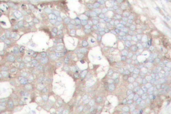 Polyclonal Rabbit anti-Human CTTN / Cortactin Antibody (Pro415, IHC, WB)
