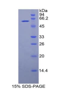 Rat SLC3A2 / CD98 Heavy Chain Protein (Recombinant His-GST)