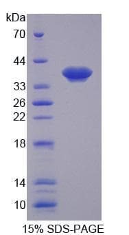 Rat MMP1 Protein (Recombinant His-T7)