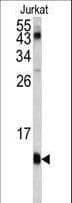 FKBP1A / FKBP12 Antibody (aa55-83)