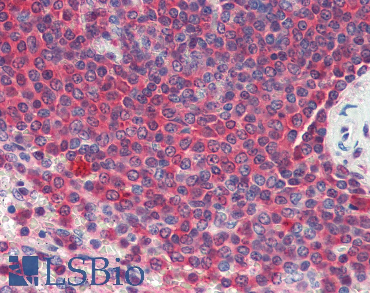 IHC-plus™ HSP90 / Heat Shock Protein 90 Antibody (clone 16F1)