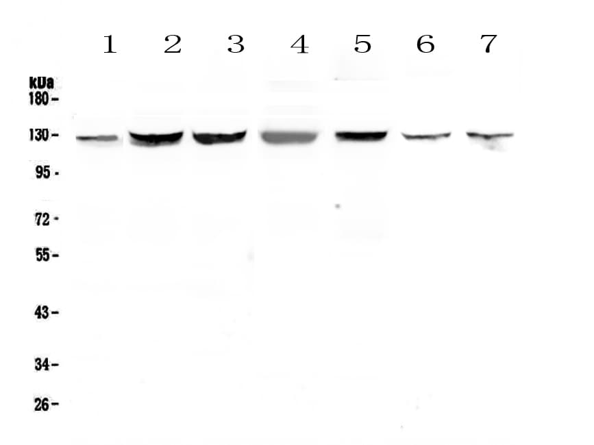 Polyclonal Rabbit anti-Human SMC6 Antibody (WB)