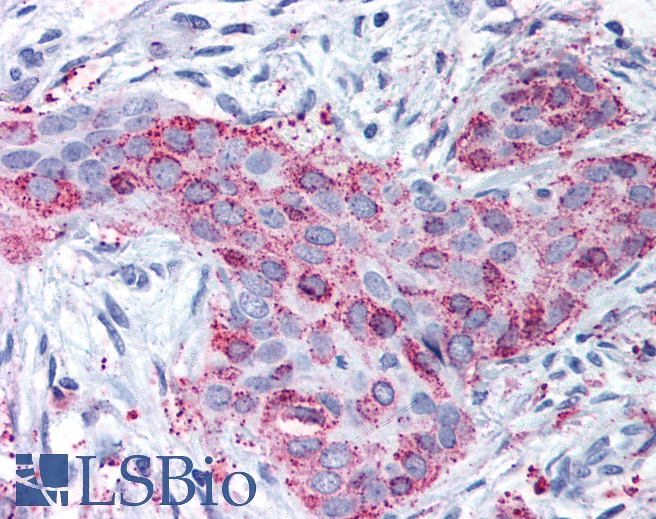 IHC-plus™ MMP13 Antibody (Internal)