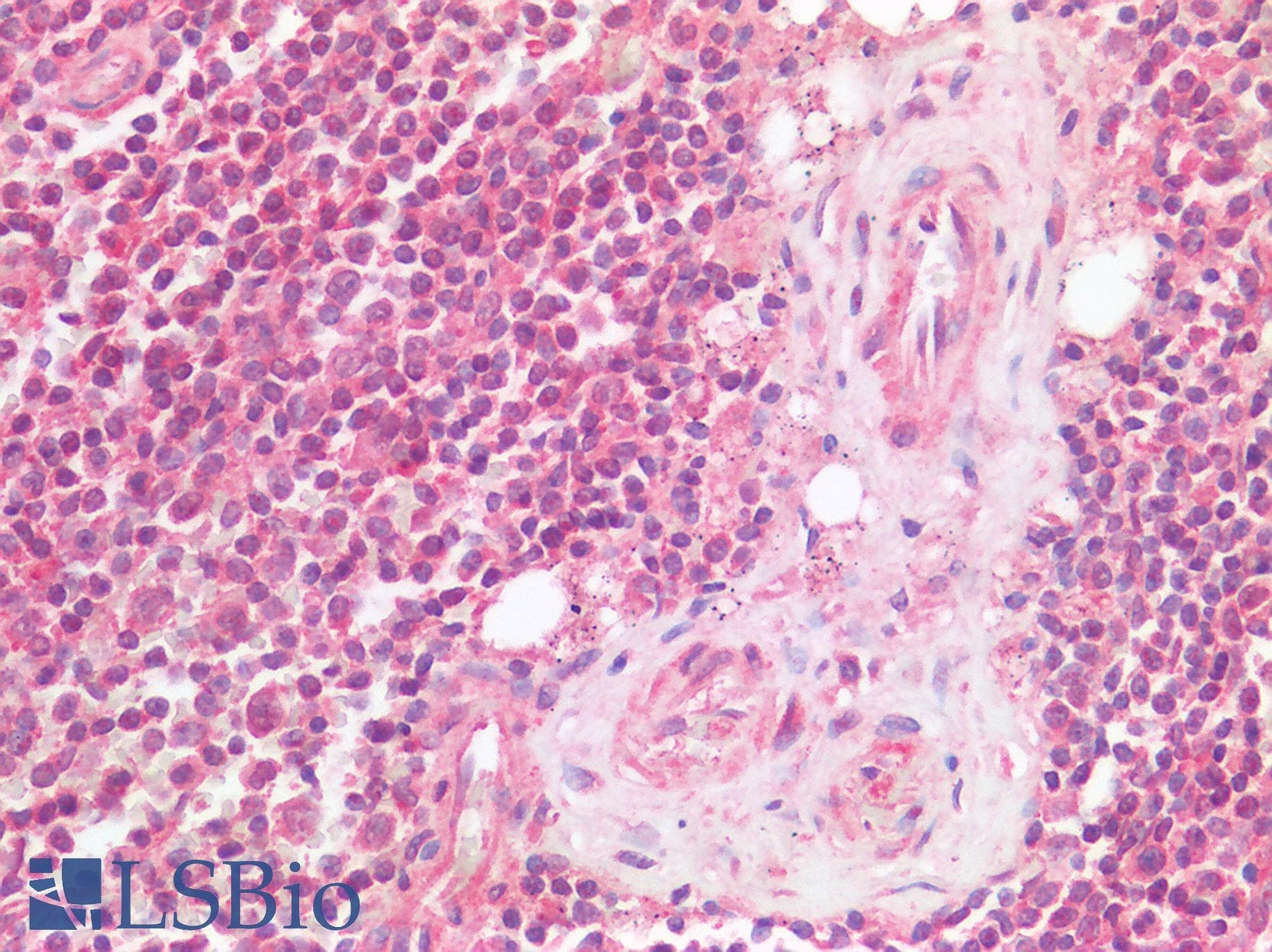 IHC-plus™ TIGIT Antibody
