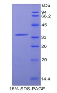 Rat AZGP1 / ZAG Protein (Recombinant His)